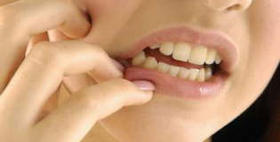 Флюс на десне