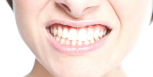 Здоровые зубы