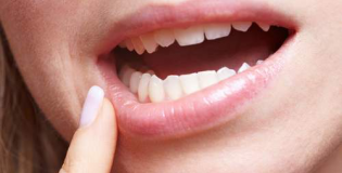 Воспаление ротовой полости