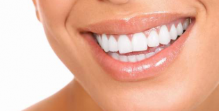 Металлокерамика на передние зубы