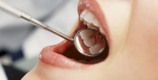 Протезировние зубов