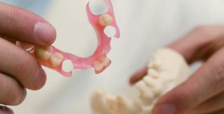 Съемные зубные протезы